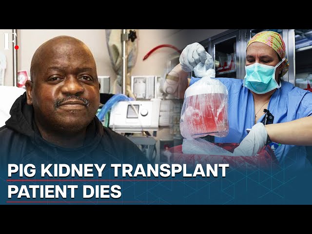 World’s first pig kidney transplant patient dies two months after surgery; Here’s what you need to know