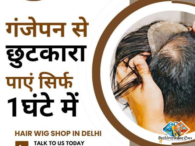 Hair Wig Shop in Delhi - Get rid of baldness in just 1 hour - 1