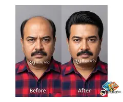 Hair Wig Shop in Delhi for Men – Stylish and Natural