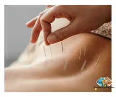 Acupuncture Treatment in Thornhill: Natural Pain Relief And Restorative Body Balance