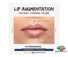 Get Fuller, Softer Lips with Expert Lip Augmentation!