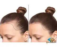 Hairline Tattoo: Redefining Confidence with Precision & Art