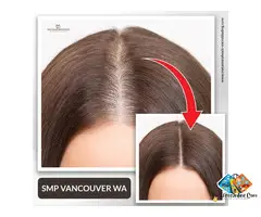 Smp Vancouver WA: Restoring Your Confidence