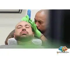 Hairline Restoration with Scalp Micropigmentation – Roseville - 9