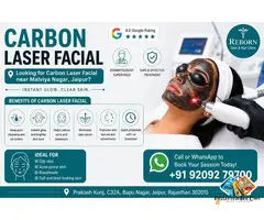 Safe Carbon Laser Facial near Malviya Nagar, Jaipur