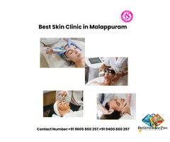 Skinnova Skin Clinic - Best Skin Clinic in Malappuram