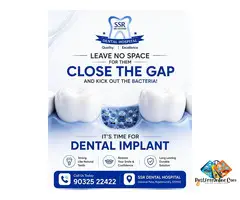 Dental Implant Specialists | SSR Dental Hospital In Rajahmundry