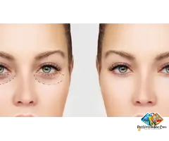 Enhance Your Appearance with Eyelid Surgery Windsor