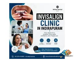 Invisalign Clinic in Indirapuram for Modern Orthodontics