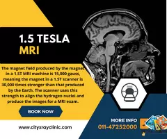 MRI 1.5 Tesla Price Know Cost Clearly Before You Book / 1