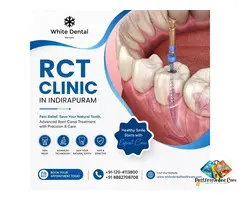 RCT Clinic in Indirapuram for Root Canal Treatment