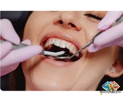 Missing a Tooth? Dental Implants in Langford