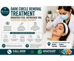 What Treatment Options Are Available for Dark Circle Treatment in Baner?