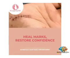 Skin Clinic in Karkardooma