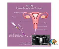 IVF and Genetic Testing in Abu Dhabi