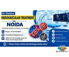 Endovascular Treatment in Noida