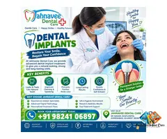 Dental Implants in Ghatlodiya – Dental Care